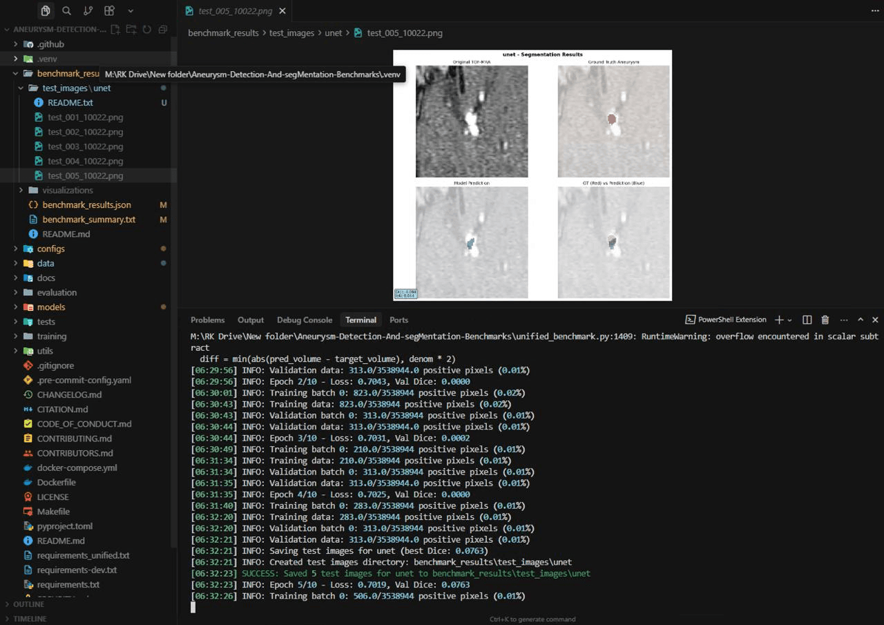 Aneurysm-Detection-And-segMentation-Benchmarks